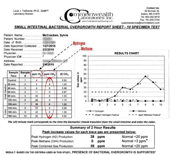 sibo test results