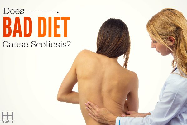 Does Bad Diet Cause Scoliosis?