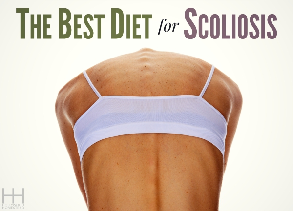 Best Diet for Scoliosis