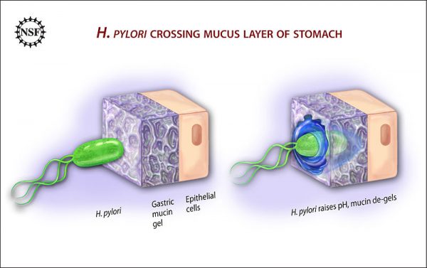 Image shows how h. pylori bacteria embed themselves in the stomach lining and cause damage.