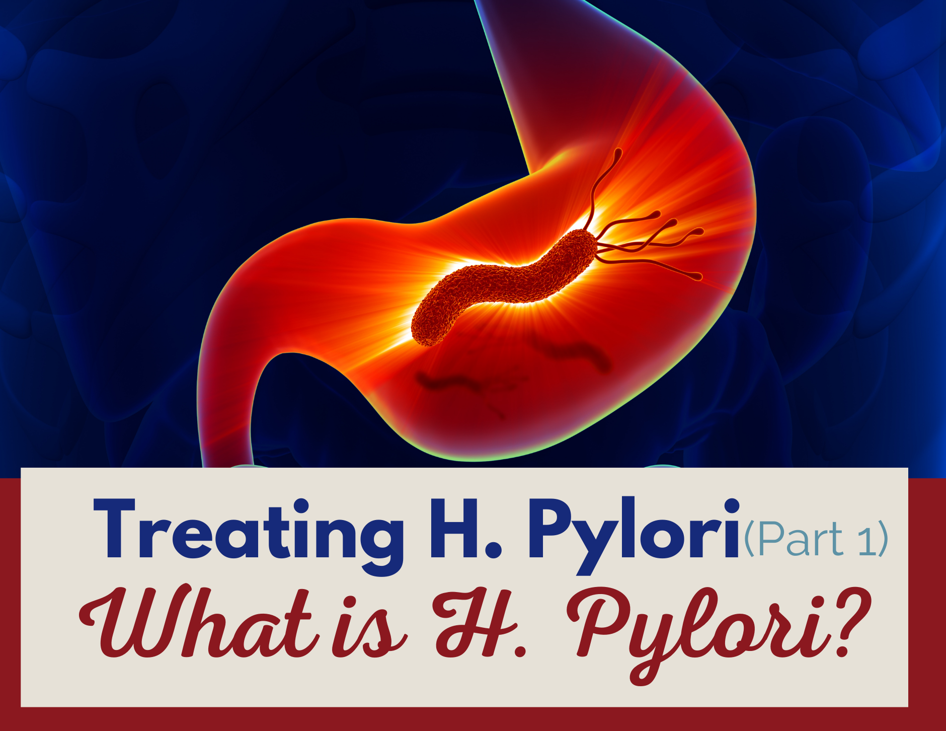 Treating H Pylori (Part 1): What is H Pylori? 