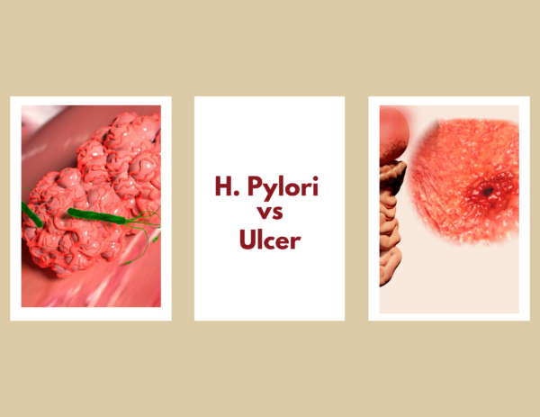 images of h pylori bacteria and stomach ulcer 