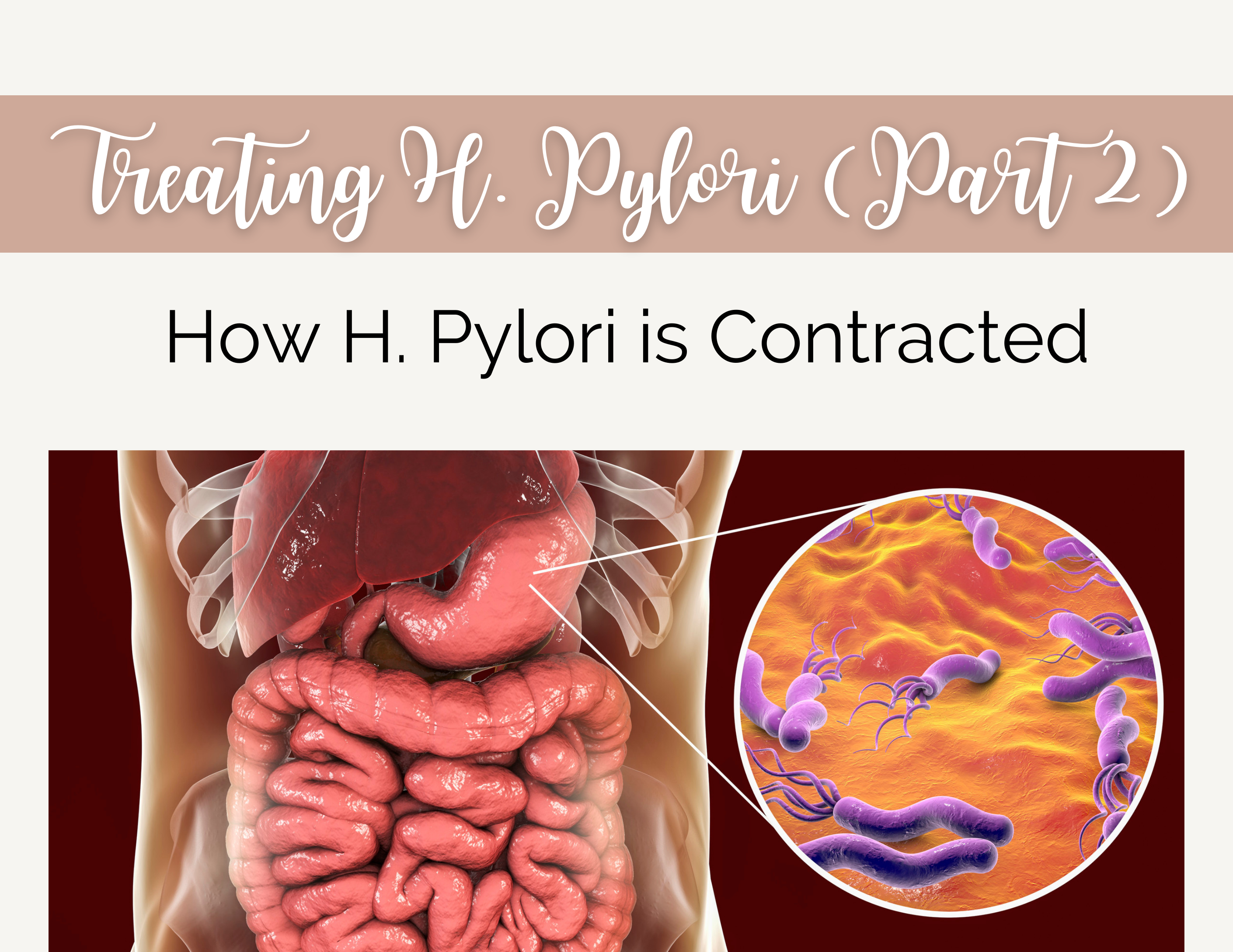 Treating H. Pylori (Part 2): How H. Pylori is Contracted